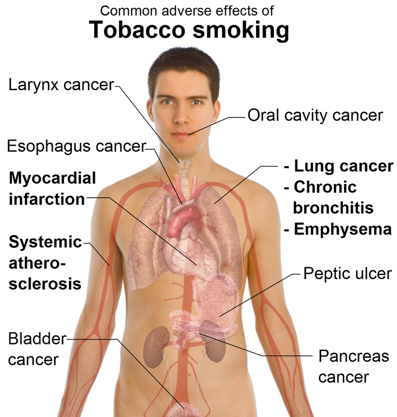 Understanding the Harmful Side Effects of Tobacco Use